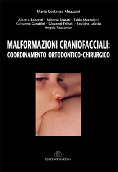 MALFORMAZIONI CRANIOFACCIALI: coordinamento ortodontico-chirurgico